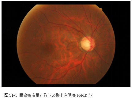 ZY016_158_4.gif